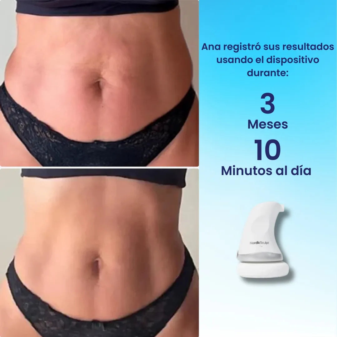 NordicSculpt ™ – Dispositivo de esculpido y firmeza en casa