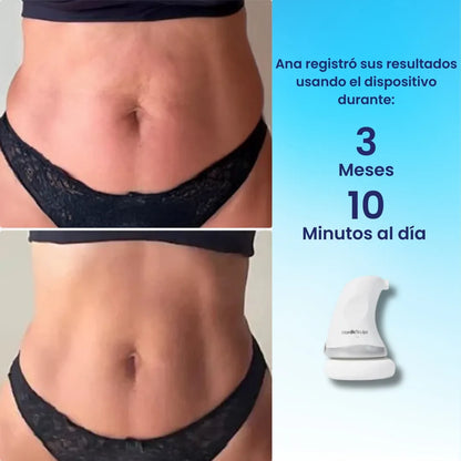 NordicSculpt ™ – Dispositivo de esculpido y firmeza en casa