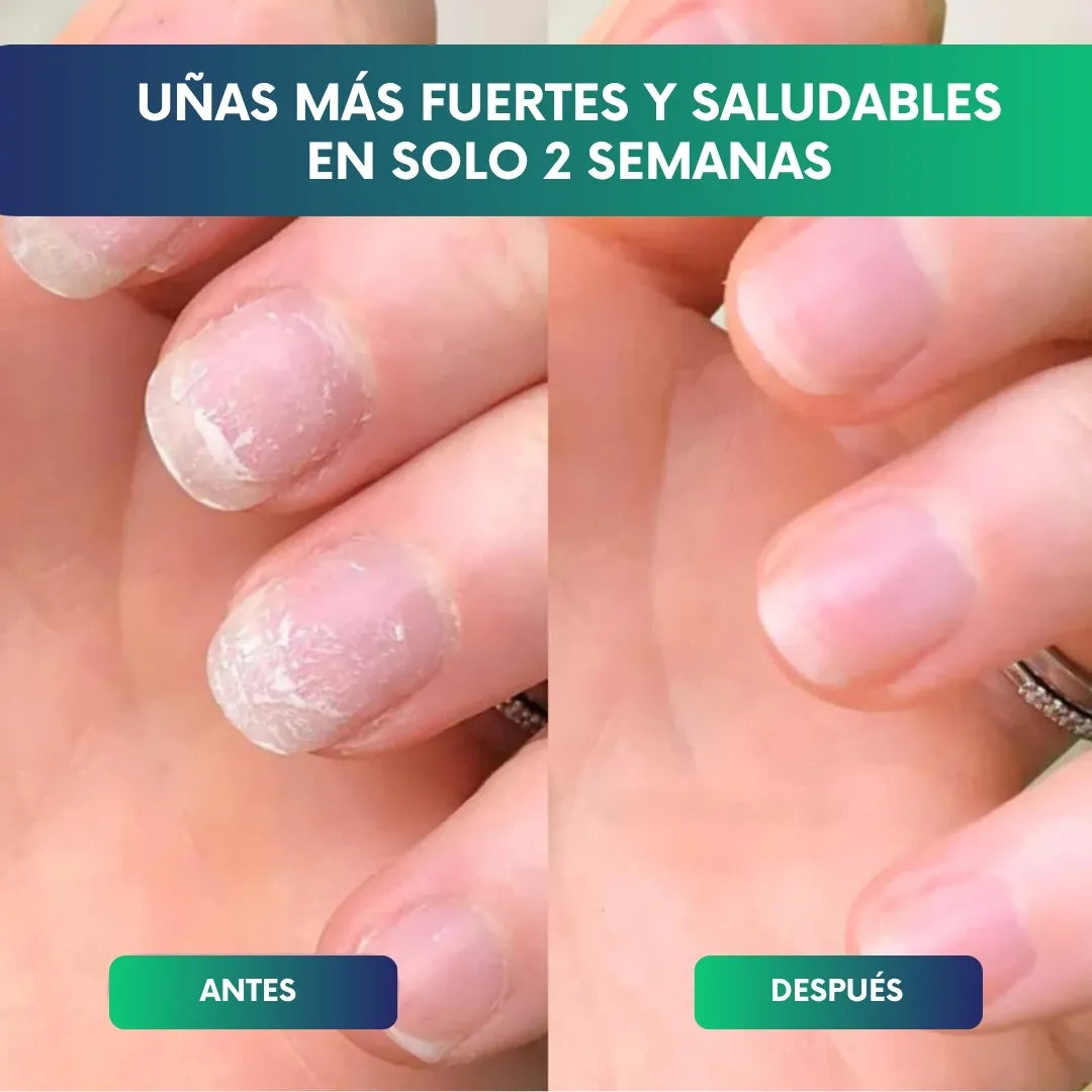 Nailixir™ - 2x1 Lápiz Serúm para el crecimiento de uñas en 2 semanas